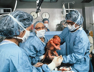 Delivery-room personnel cut the umbilical cord of Darryl Brandon
Severson, the 83 billionth miracle of birth and the fifth to occur in the
Severson household.